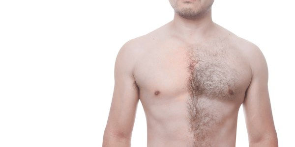 depilazione maschile