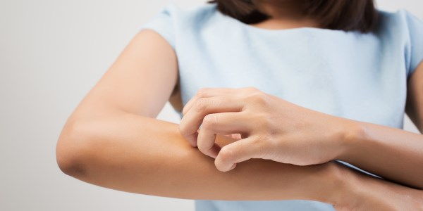 rimedi naturali prurito