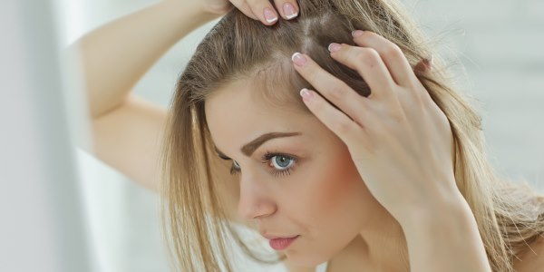 calvizie femminile
