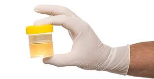 provetta urina U-Lab