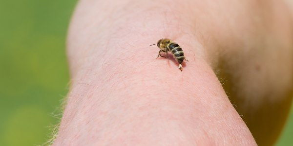 Ape puntura di ape