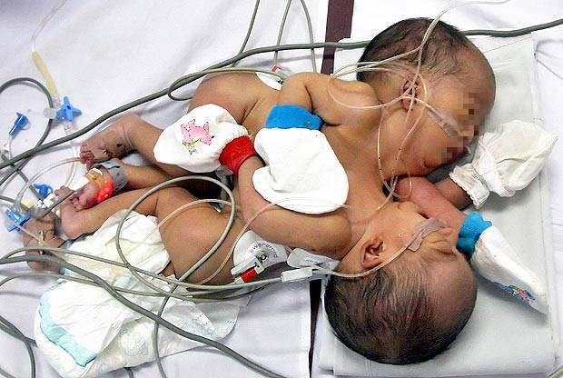 foto: newnotizie.it - siamesi a bologna